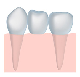 denture solutions with a dentist Gonzales LA