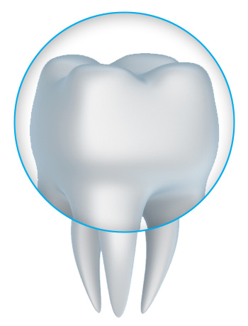 Zirconia crowns with a Prairieville and Baton Rouge dentist