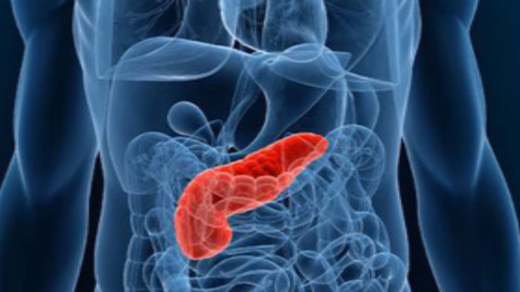 periodontal pancreatic cancer link