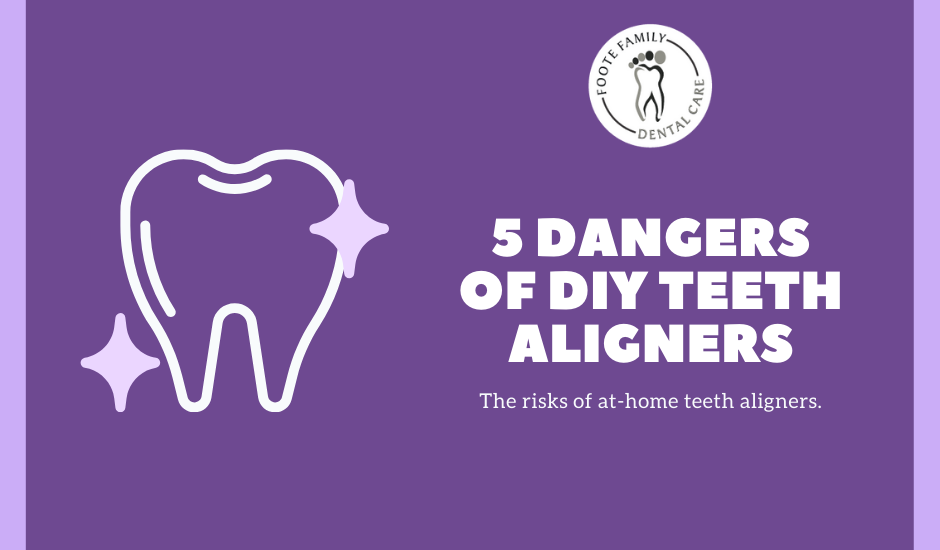 diy teeth aligners