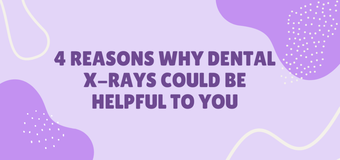 Four Reasons Why Dental X-Rays Could Be Helpful to You